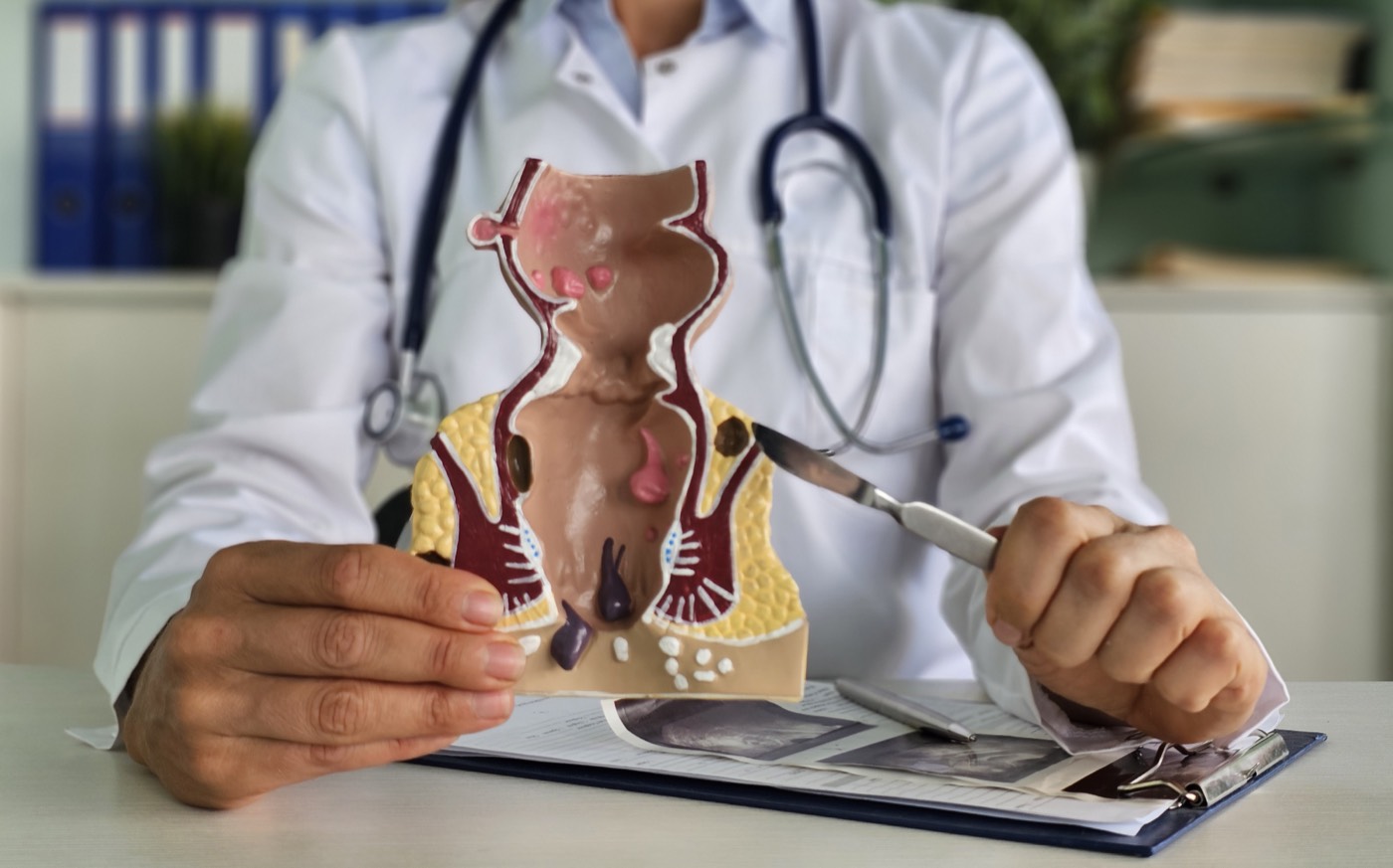 A physician holding an anatomical model of the anal canal, with the scalpel crossed out